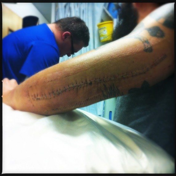 arm